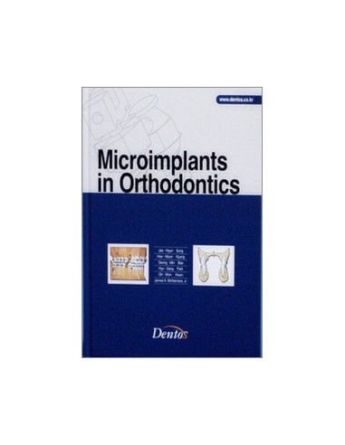 Microimplants in Orthodontics